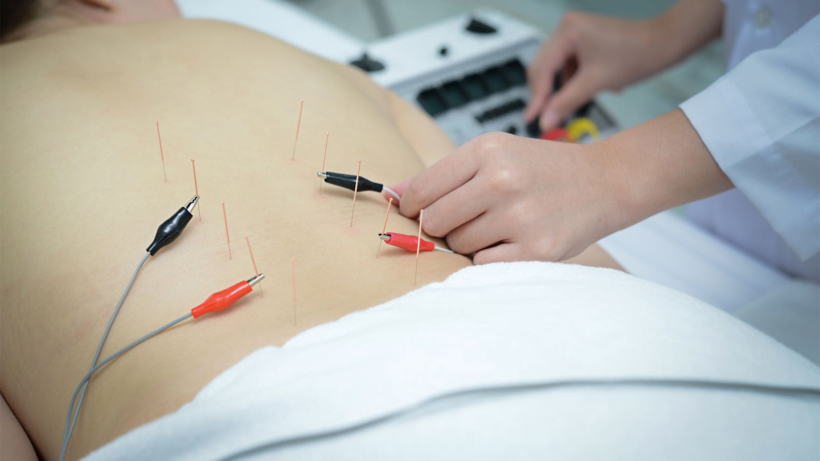 Acupuncture for HIV Treatment